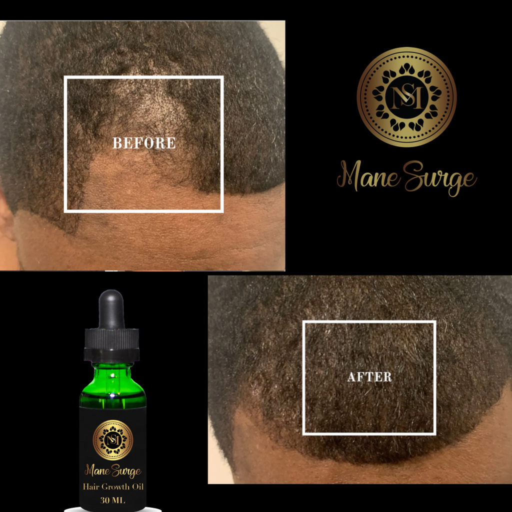 Mane Surge Hair Growth Oil Results 10