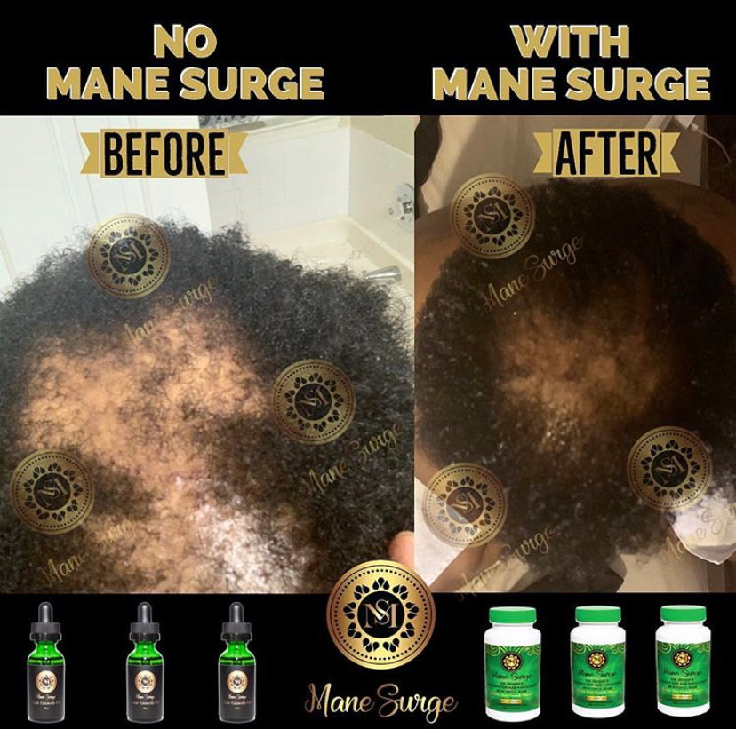 Mane Surge Hair Growth Oil Results 11