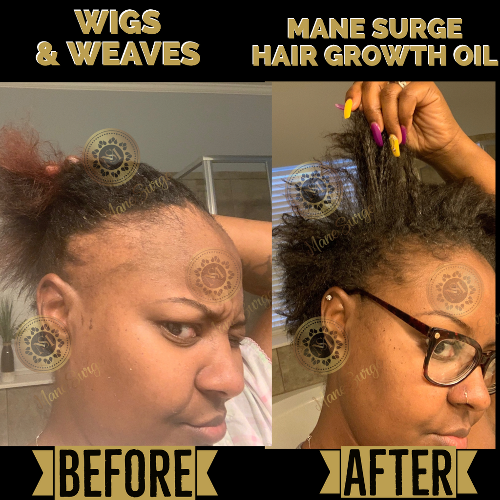 Mane Surge Hair Growth Oil Results 1