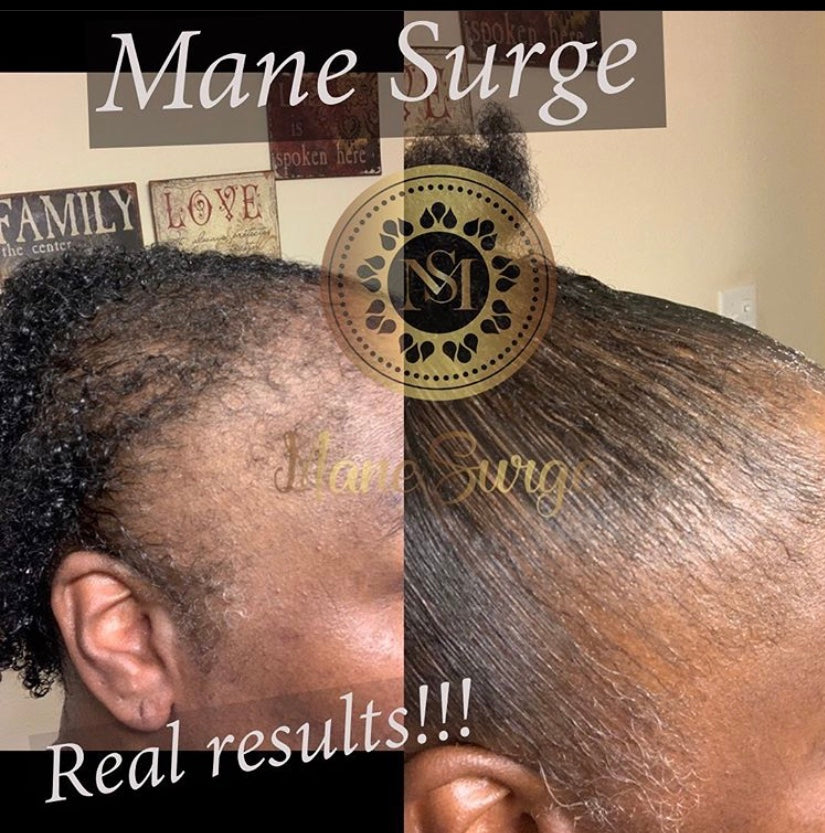 Mane Surge Hair Growth Oil Results 8