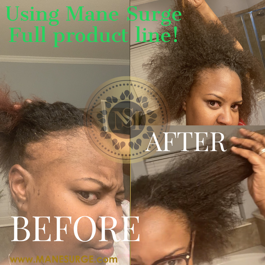 Mane Surge Hair Growth Oil Results 21